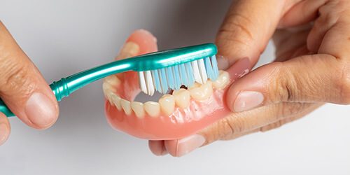 Pflege und Reinigung eines Zahnimplantats